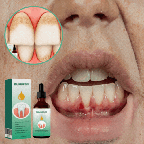 Gumreset® Tandvlees Herstel | Herstelt terugtrekkend tandlees voor 94% in 6 dagen