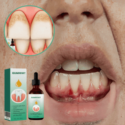 Gumreset® Tandvlees Herstel | Herstelt terugtrekkend tandlees voor 94% in 6 dagen